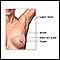 Mastectomy - series - Normal anatomy