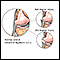 Lateral collateral ligament injury