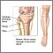 Common peroneal nerve dysfunction