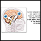 Cranial calcification