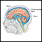 Cerebrospinal fluid leak