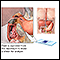 Duodenum tissue smear