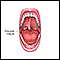 Macroglossia