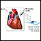 Pericardial fluid stain