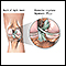 Ligamento cruciforme posterior de la rodilla